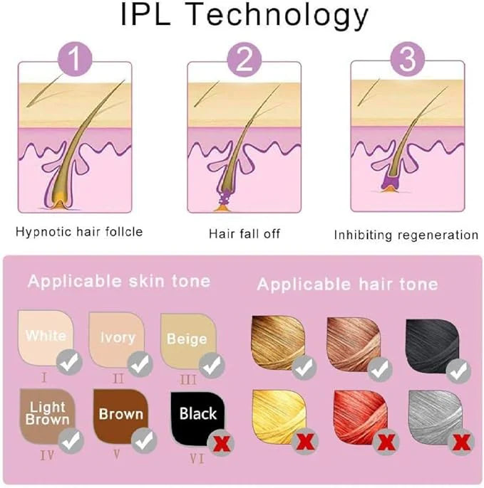 جهاز IPL لإزالة الشعر المنزلي
