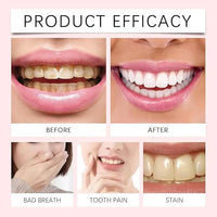 معجون أورالهو لتبييض الأسنان بلطف - Oralhoo Gentle Whitening Paste