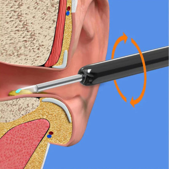 جهاز فحص الأذن بتقنية واي فاي من رائق - Rawiq Wi-Fi Ear Cleaning Device