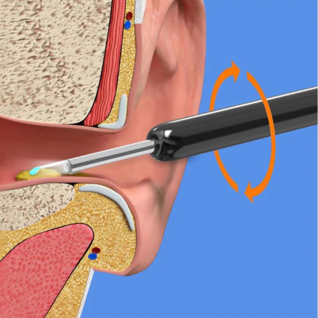 جهاز فحص الأذن بتقنية واي فاي من رائق - Rawiq Wi-Fi Ear Cleaning Device